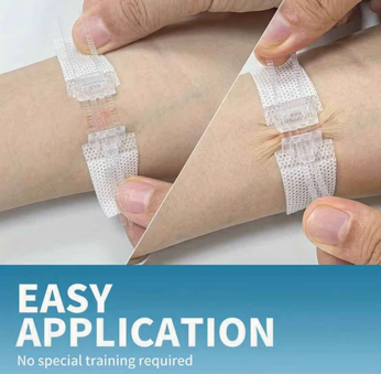 10 Unidades de Suturas Adhesivas para Cierre